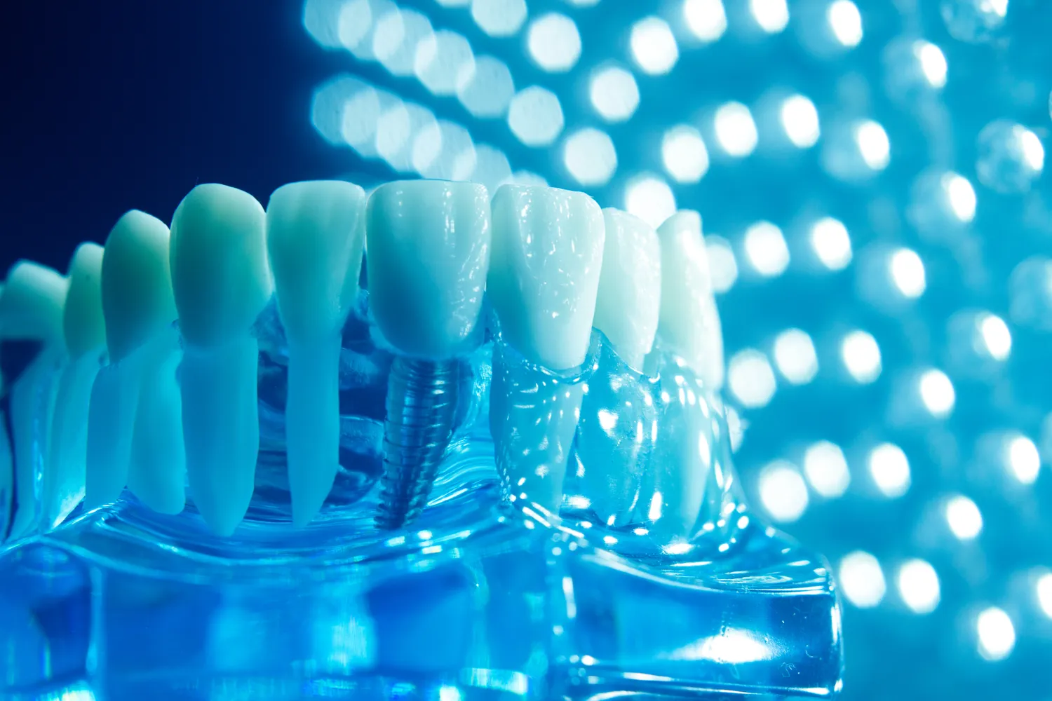 Endodoncja mikroskopowa Szczecin